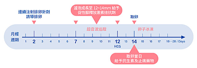 試管嬰兒,ivf