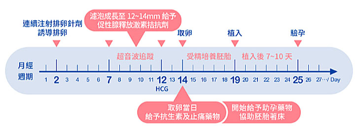 試管嬰兒ivf 試管嬰兒ivf 提高試管嬰兒ivf成功率四大流程 孕醫生殖中心